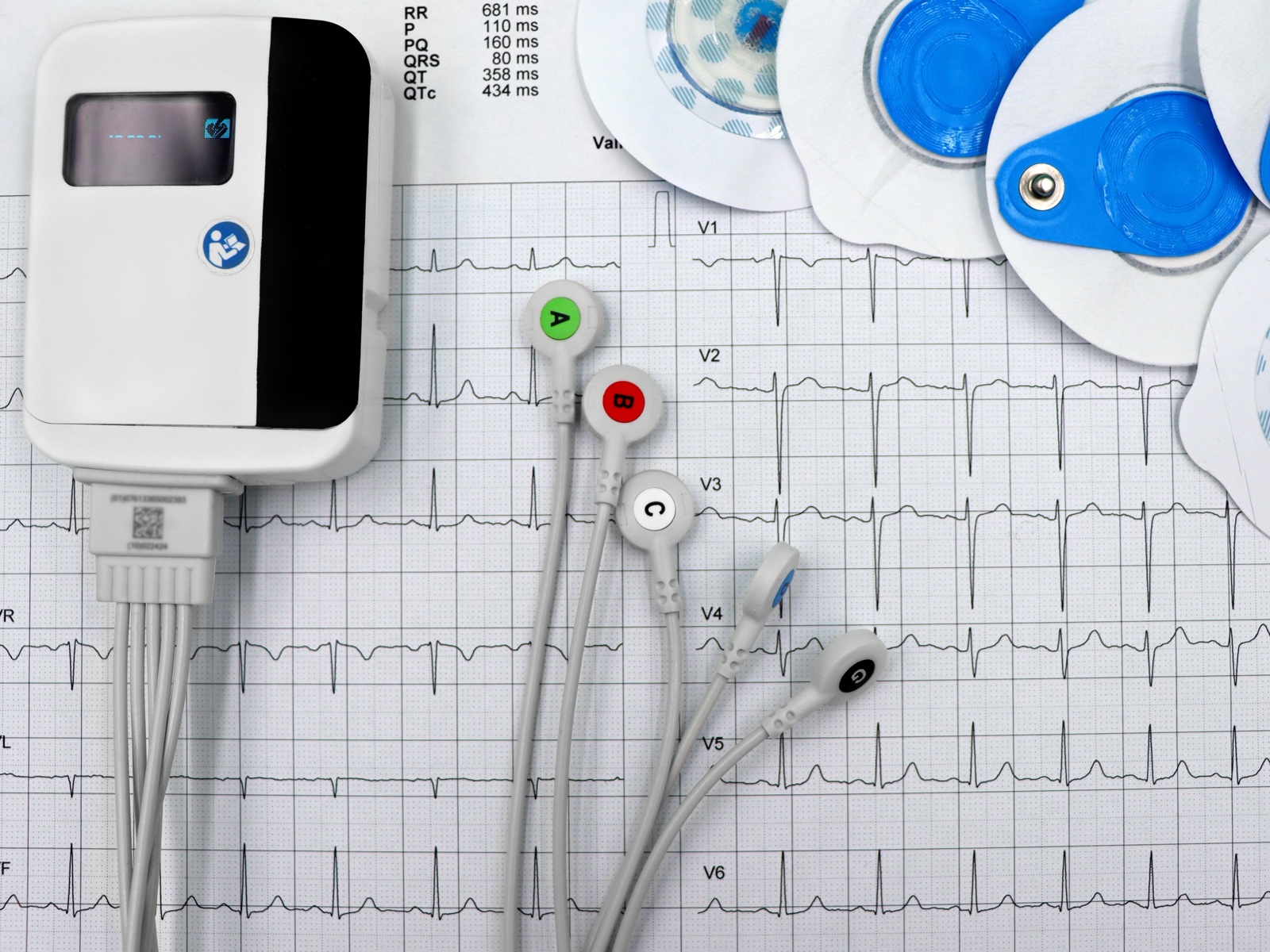 Tragbarer EKG-Rekorder mit Kabeln und Klebeelektroden auf einem EKG-Ausdruck